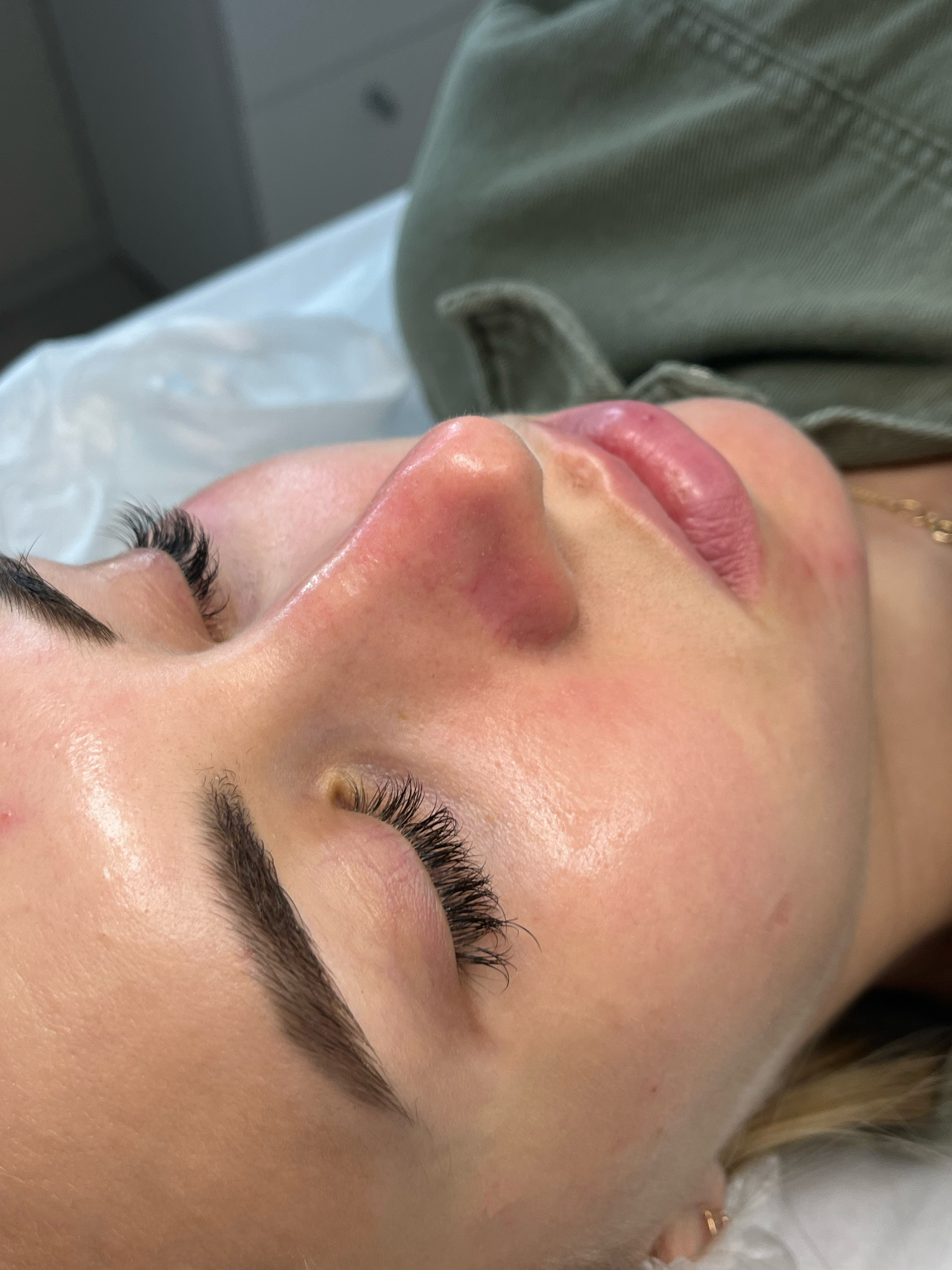 After personalized facial showing brighter, healthier complexion