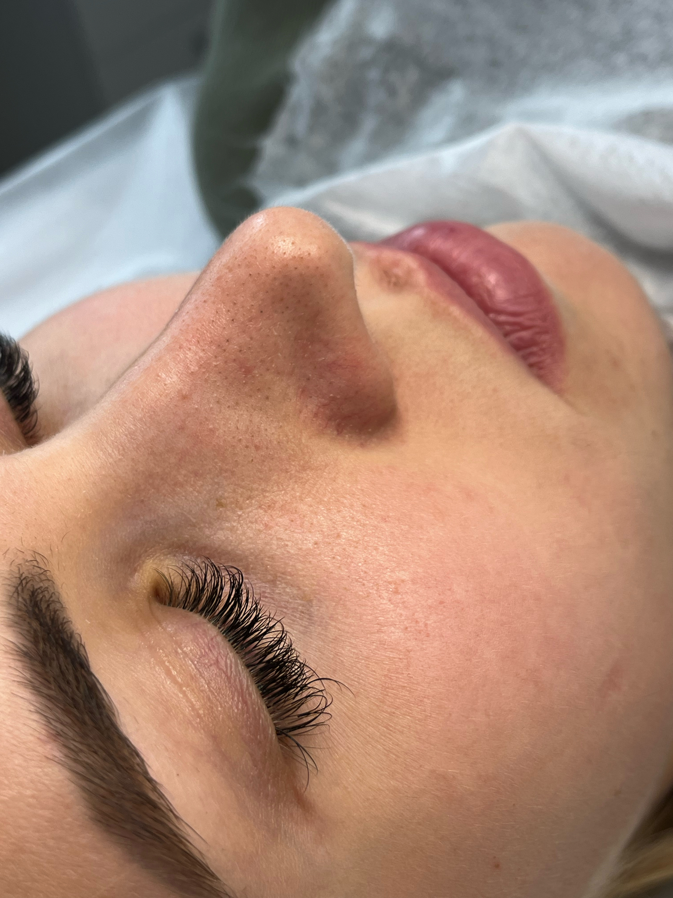 Before personalized facial and express glow treatment