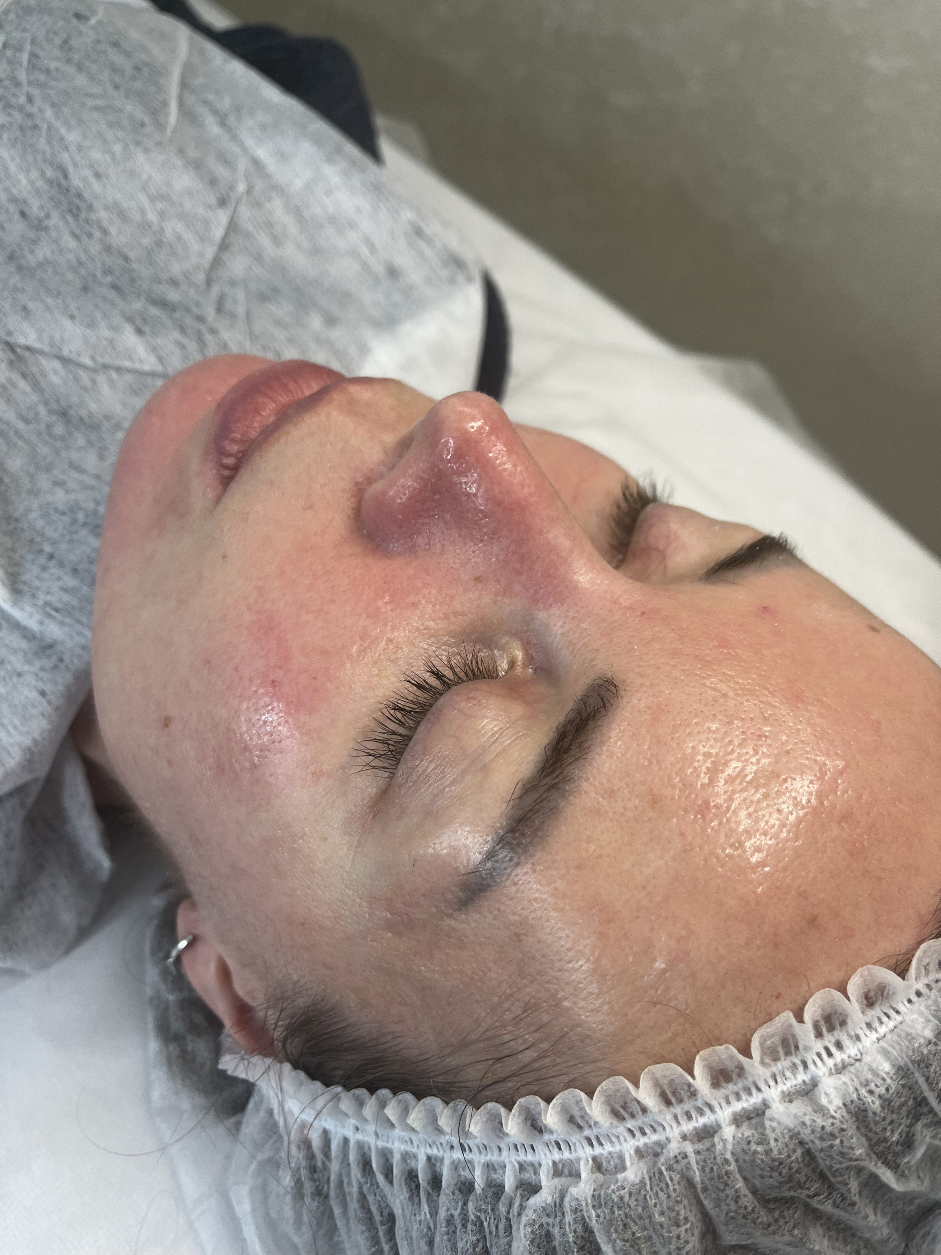 After personalized facial showing smoother, more even skin texture